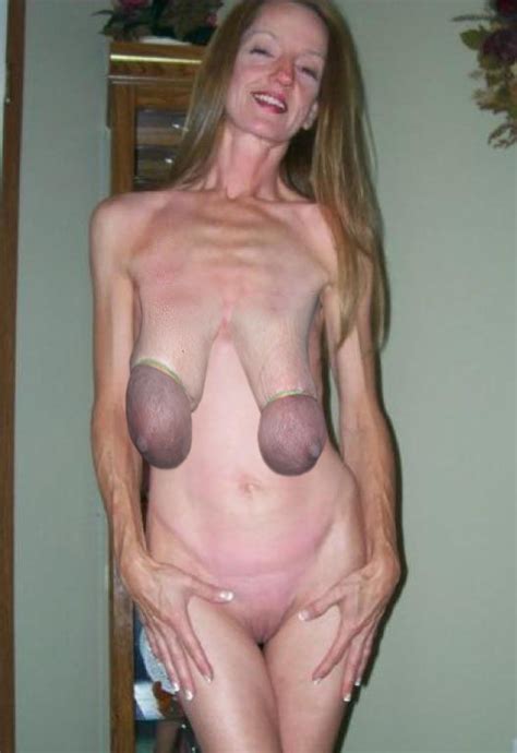 ugly saggy boobs - Mega Porn Pics