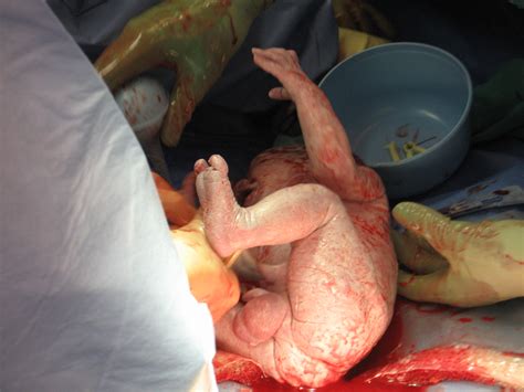 Pictures Of Women In The Middle Of Giving Birth - Milf ...